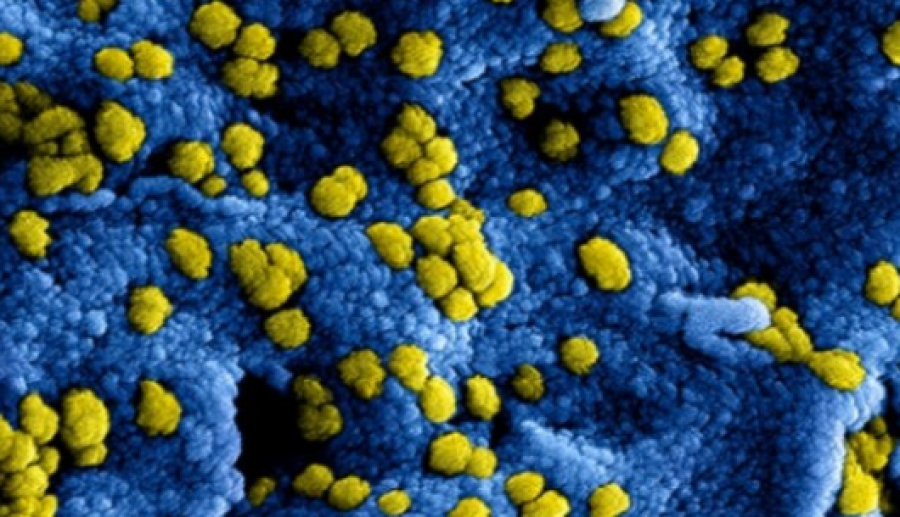 Coronavirus: OZHZ volgt de landelijke richtlijnen